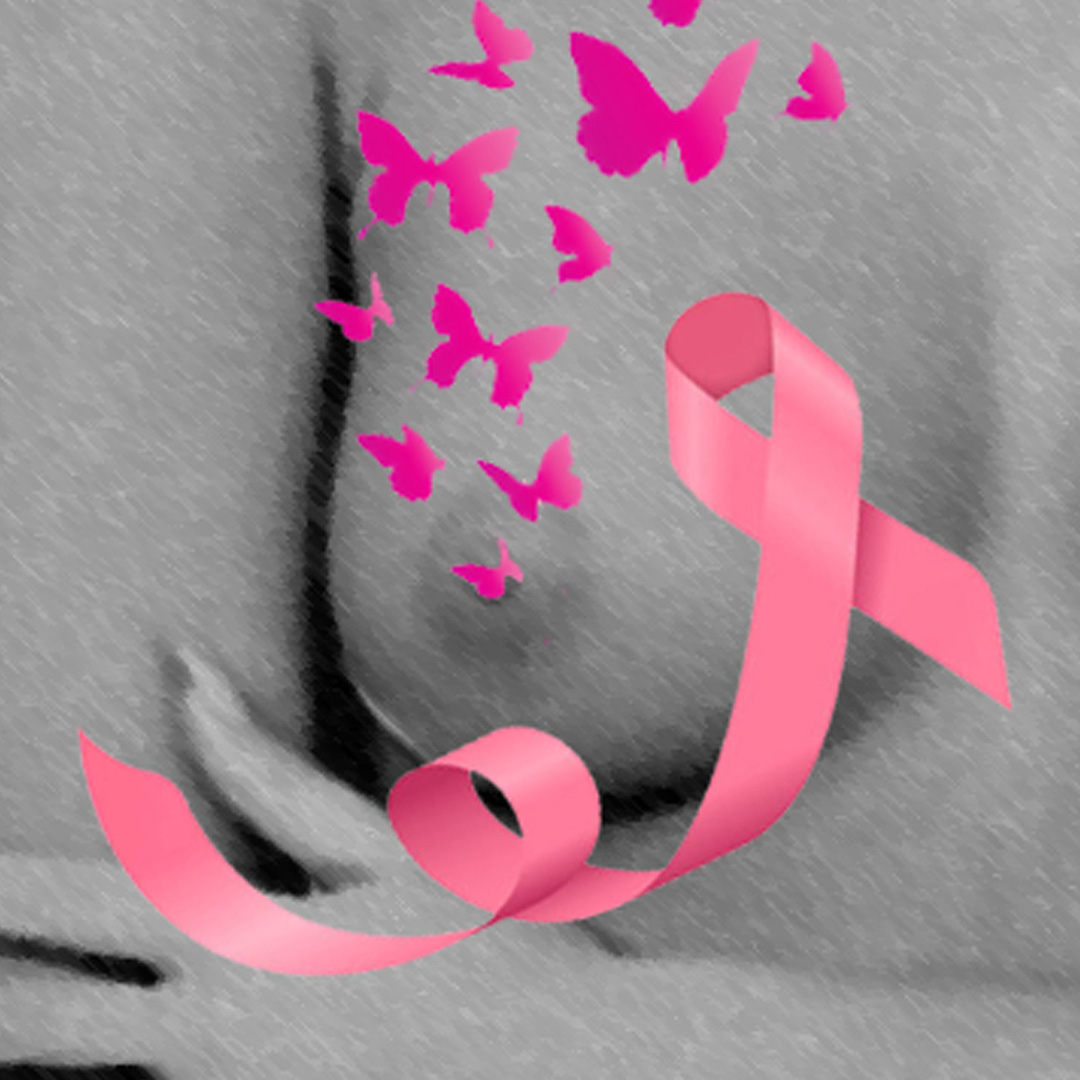 Tatuaje reconstructivo en Mataró